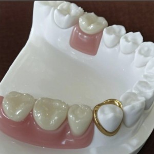 Atașament de precizie